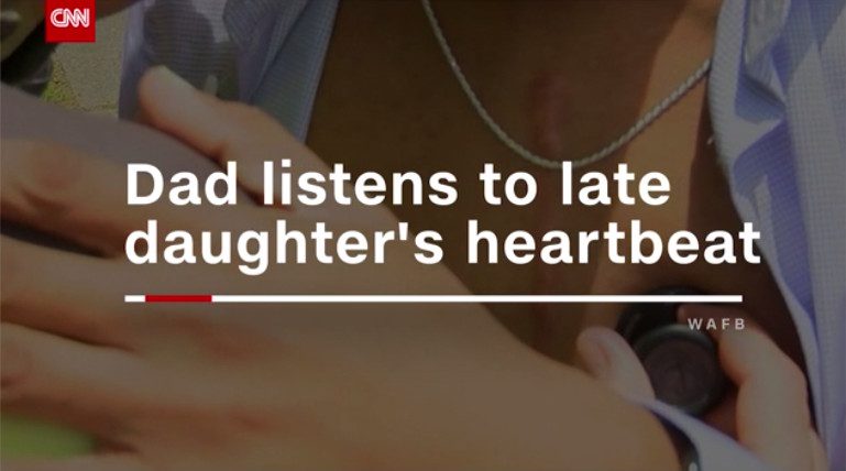 heartbeat cnn