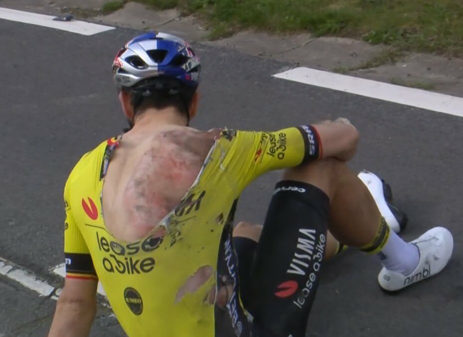 Team releases news about Wout van Aert’s injuries and effects on Classic season